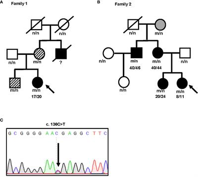 A Novel Nonsense INS Mutation Causes Inefficient Preproinsulin Translocation Into the Endoplasmic Reticulum